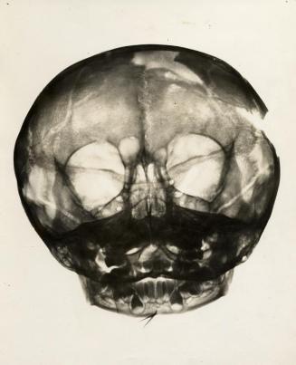 Cráneo de cueva de Berna